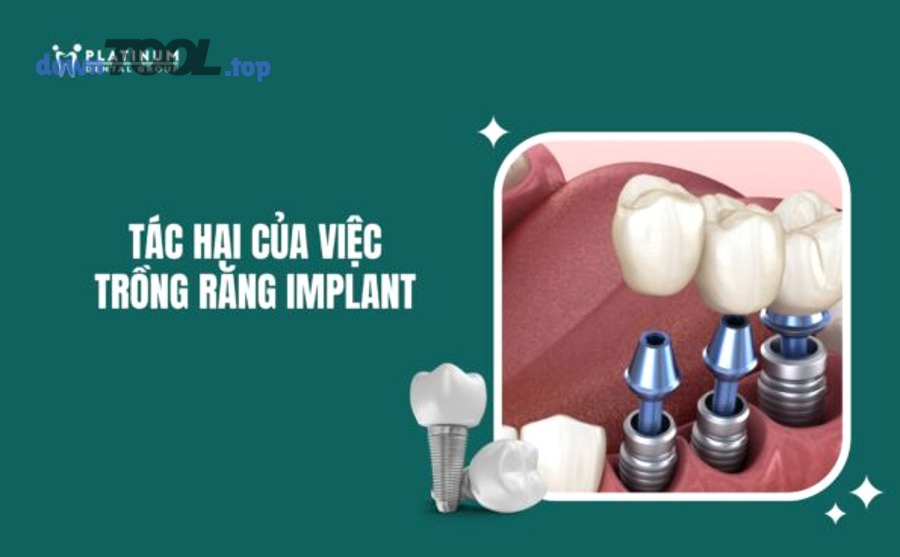 Bảng checklist tiêu chí chọn phần mềm chat nhóm miễn phí cho công việc